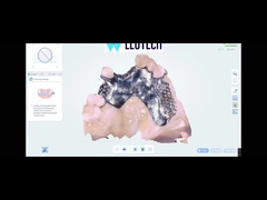 LMAI-30 Intraoral Scanner Scanning Process