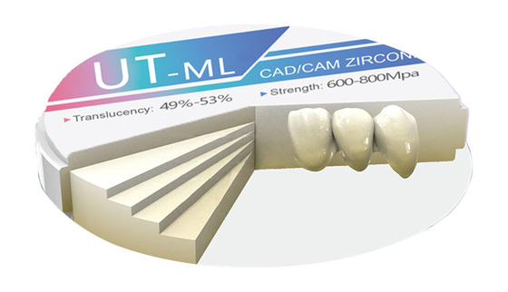 Beli Bahan Zirkonia Gigi UT-ML Grade 600-800MPa Kekuatan & 49-53% Translusensi untuk Mahkota/Jembatan pembuatan online