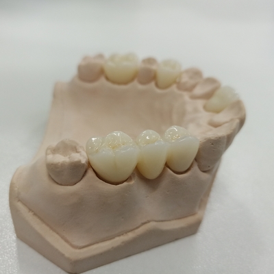 kaufen 3D-Pro-ML All-in-One Zirkonoxid Restauration, 900-1200 MPa Biegefestigkeit, Vollkontur Online-Herstellung