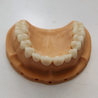 comprare SHT Complete Zirconia System Blocks Colorazione Liquidi e Protocolli per soluzioni dentali di lunga durata fabbricazione online