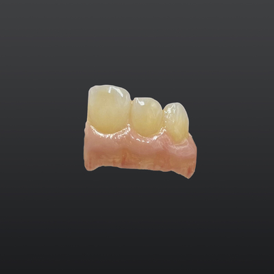 kopen Klasse II All-in-one vlek glazuurpasta voor Zirconia kronen 4 belangrijkste 18 effect tinten Single Application Handmatige voedingsbron online vervaardiging