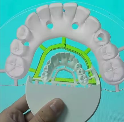 LMW-5 Wet/Dry Milling 16 Tool Capacity Lithium Disilicate Remote Control - 11