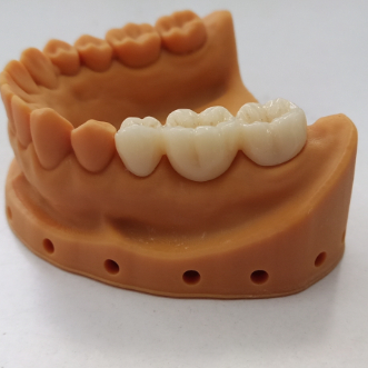 Fast-Sinter SHT Zirconia Block , 90-Minute Turnaround , 1500°C Protocol