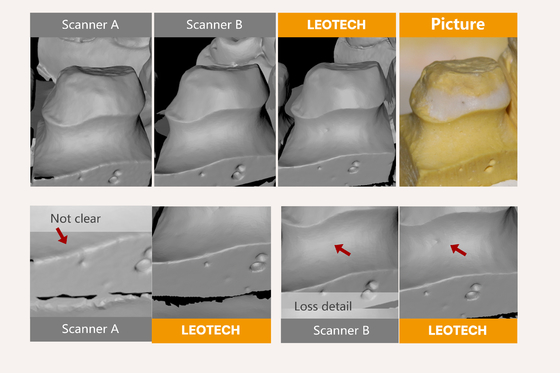 Speed USB 3.0 Interface Ultra-Speed Scanning CAD CAM Dental Scanner Fast and Detailed for Quick Case Turnaround
